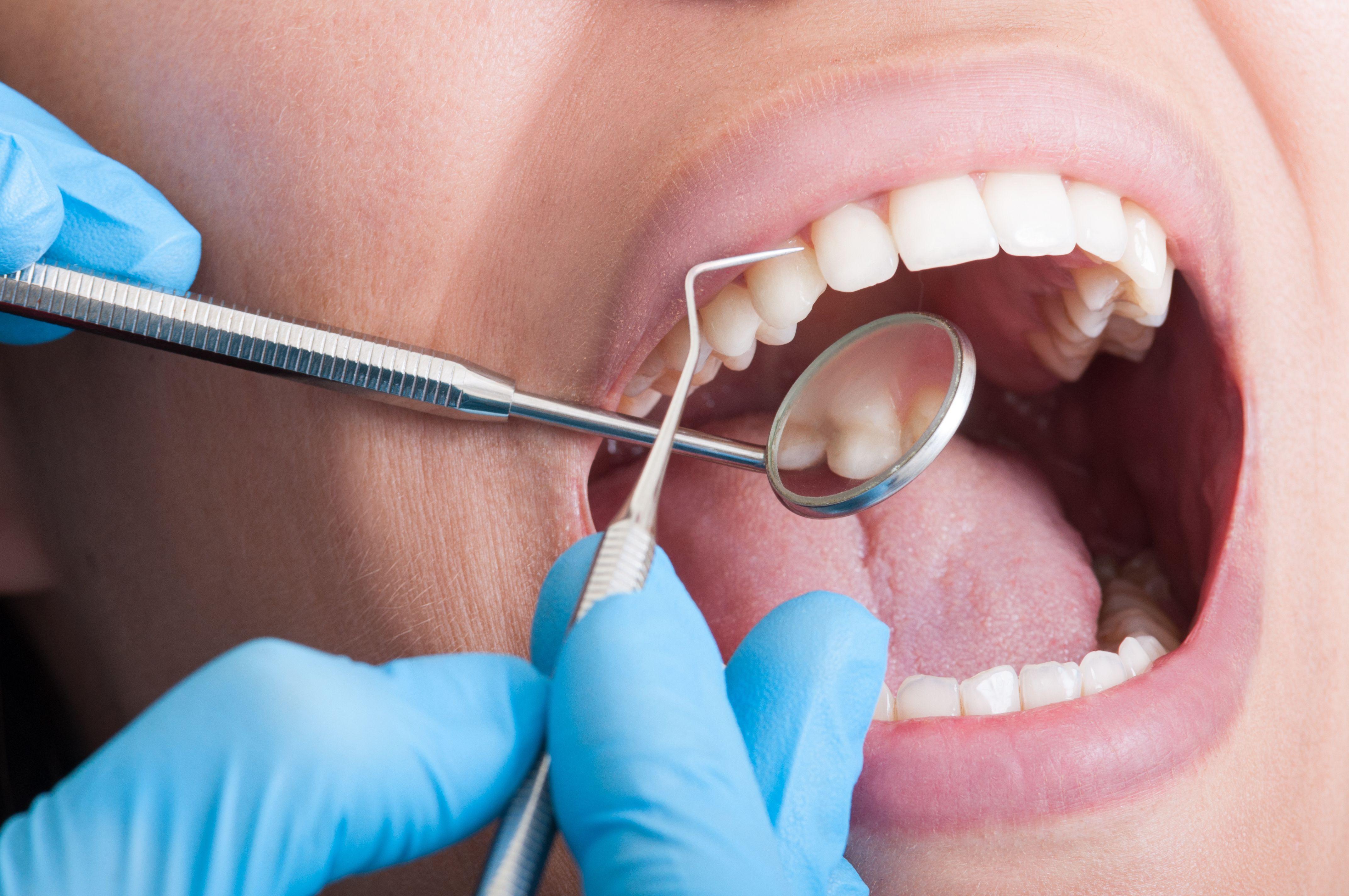Dental hygeinist