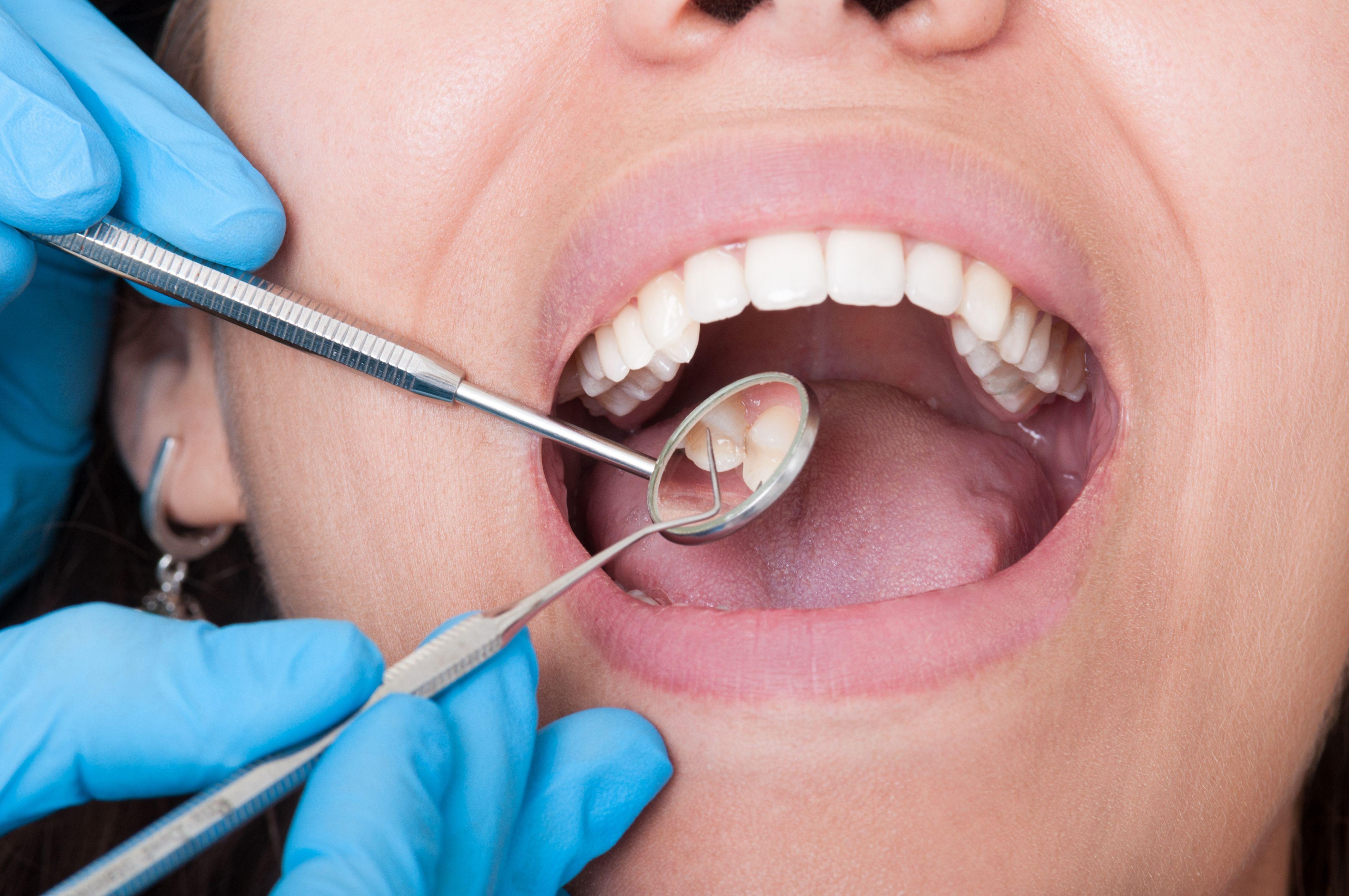 Regular dental checkups