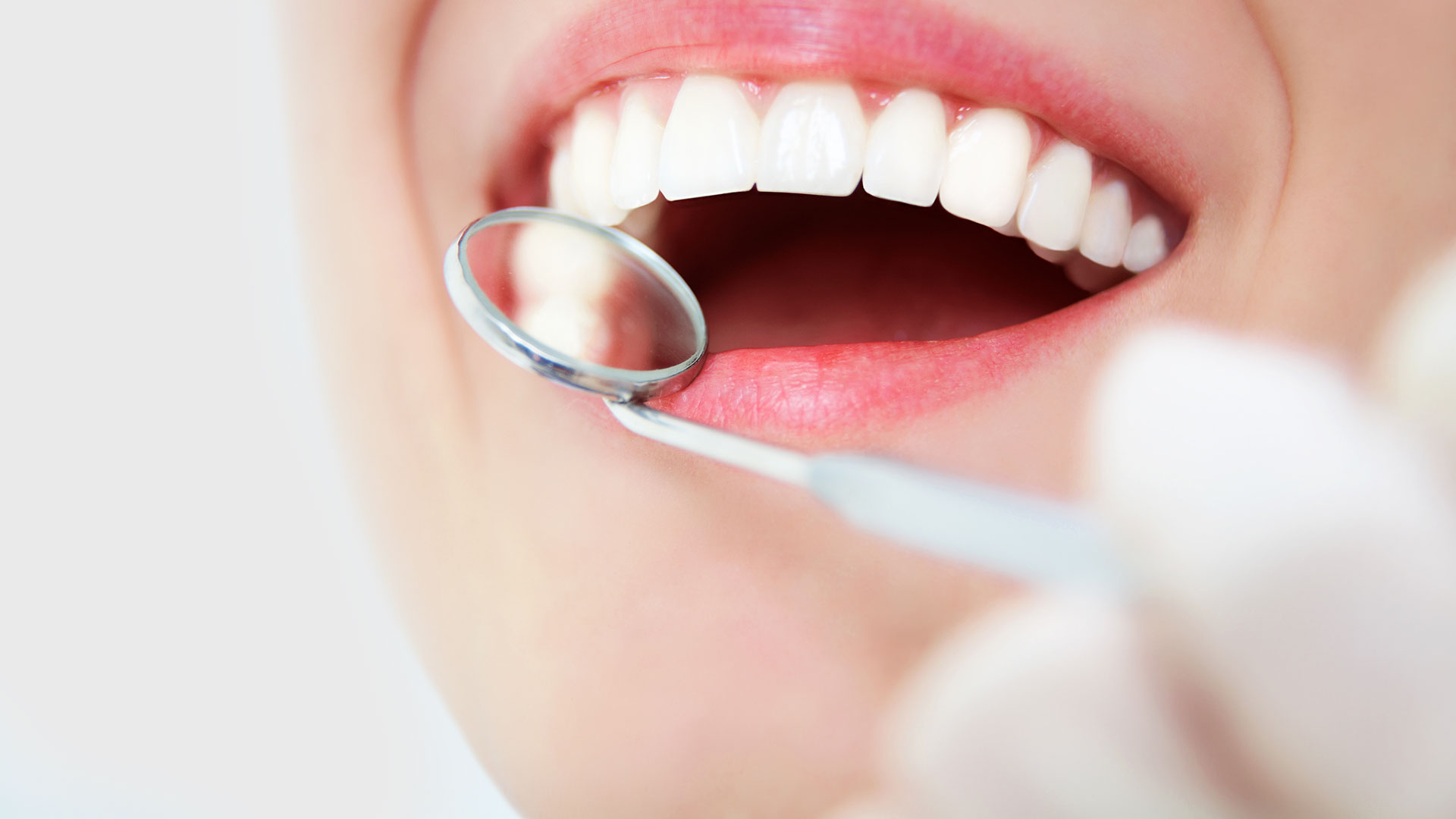 Honest Guide To Teeth Whitening Honest Guide To Teeth Whitening